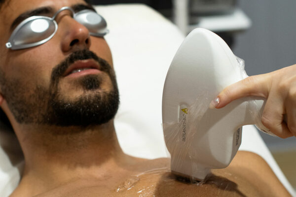 Depilaser professionale per risultati duraturi e pelle liscia!